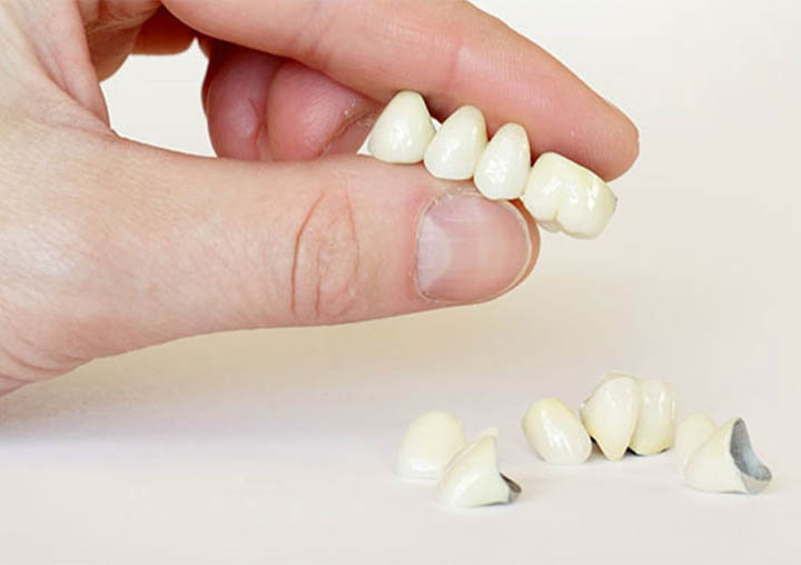 Как восстановить зубной цемент